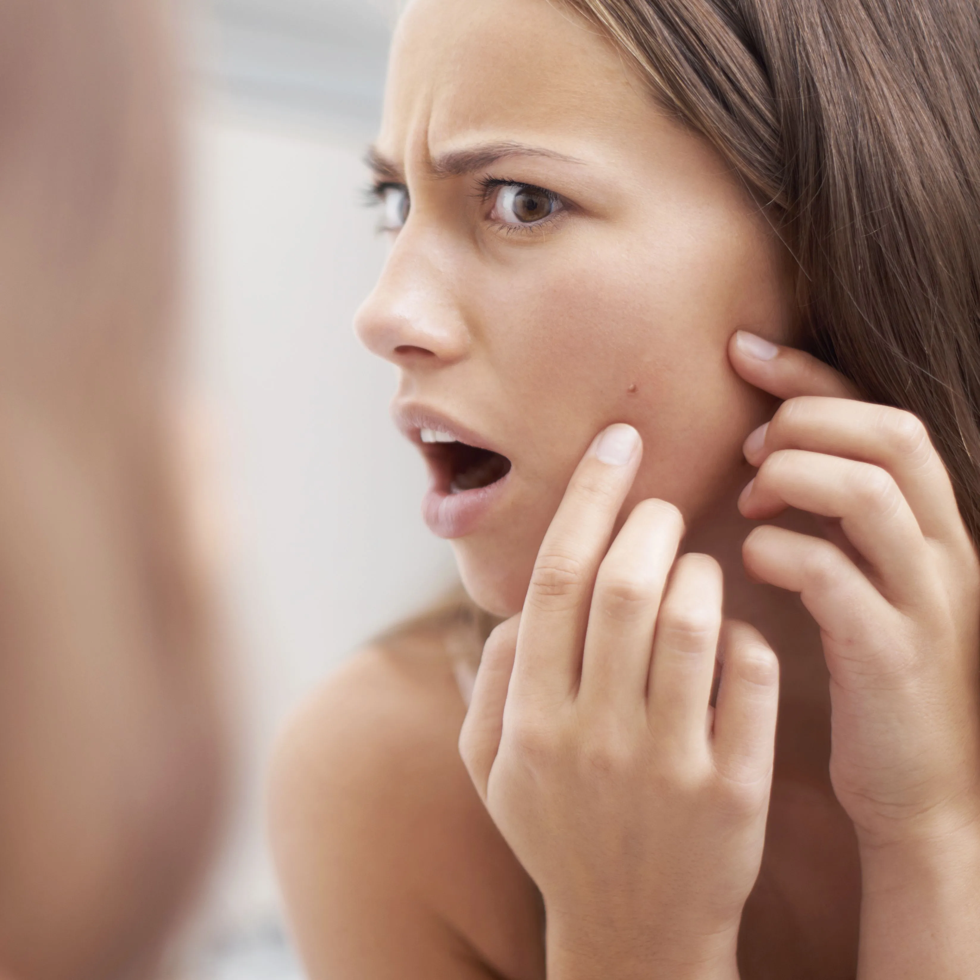 Adult Acne Most Popular Causes and Questions-Mediterranean Beauty
